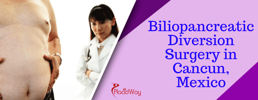 Biliopancreatic Diversion Surgery in Cancun, Mexico